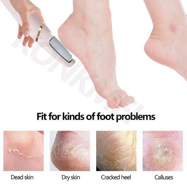 Foot Scrubber (For dry and cracked feet-HomeHq