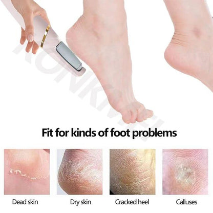 Foot Scrubber (For dry and cracked feet-HomeHq